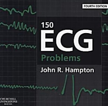 150-ecg-problems-080135817